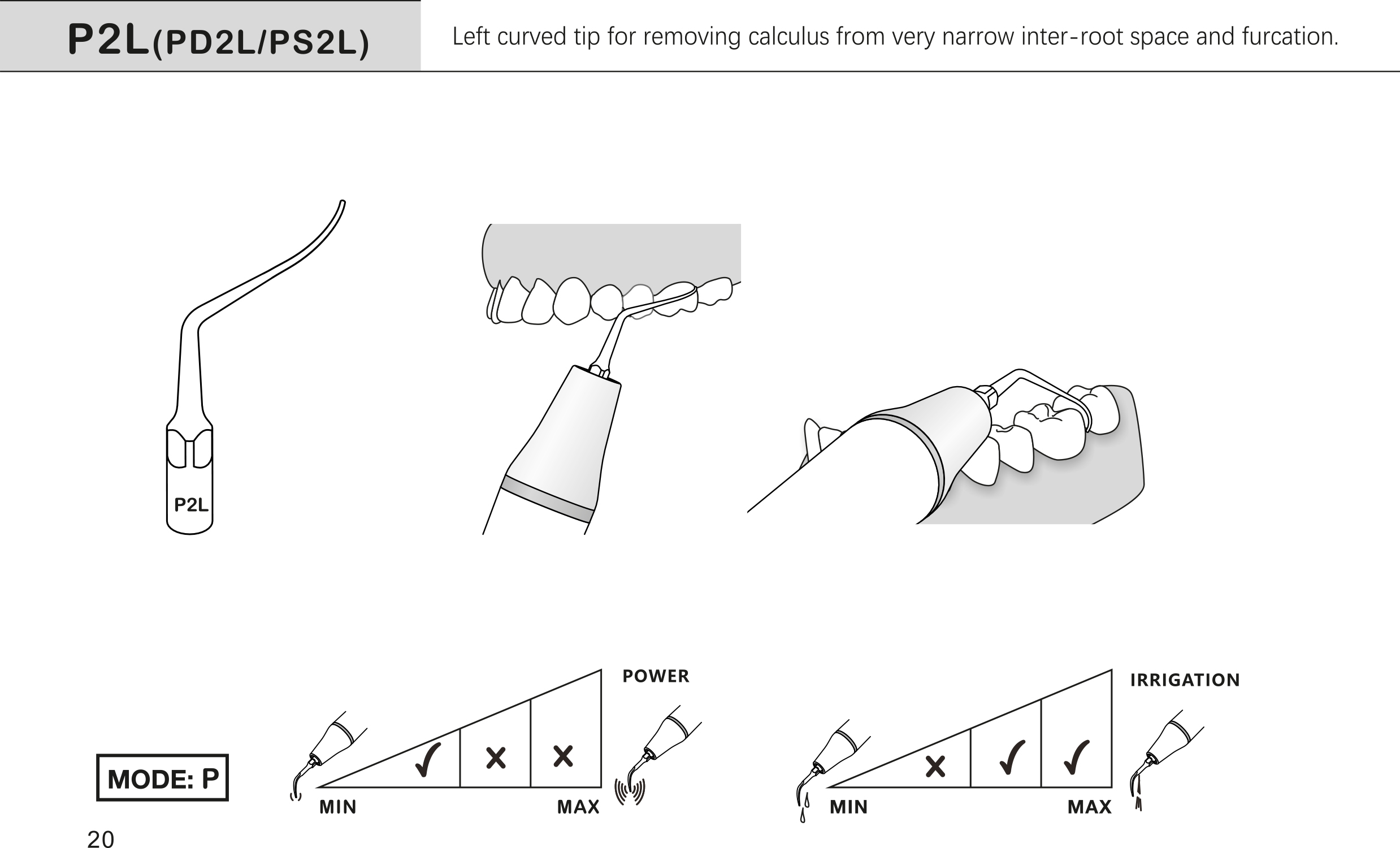 P2L
